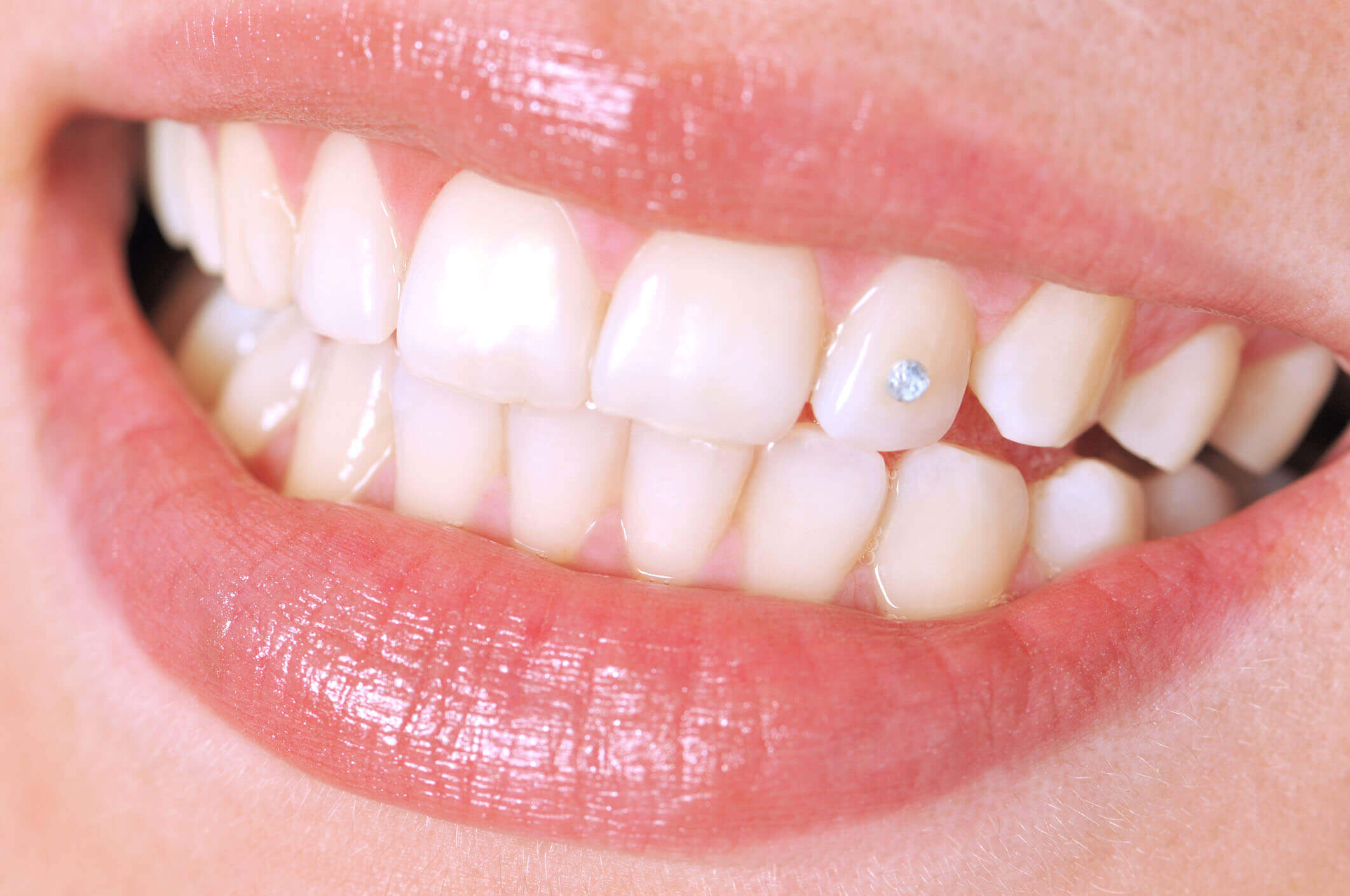 Diamond Dentistry